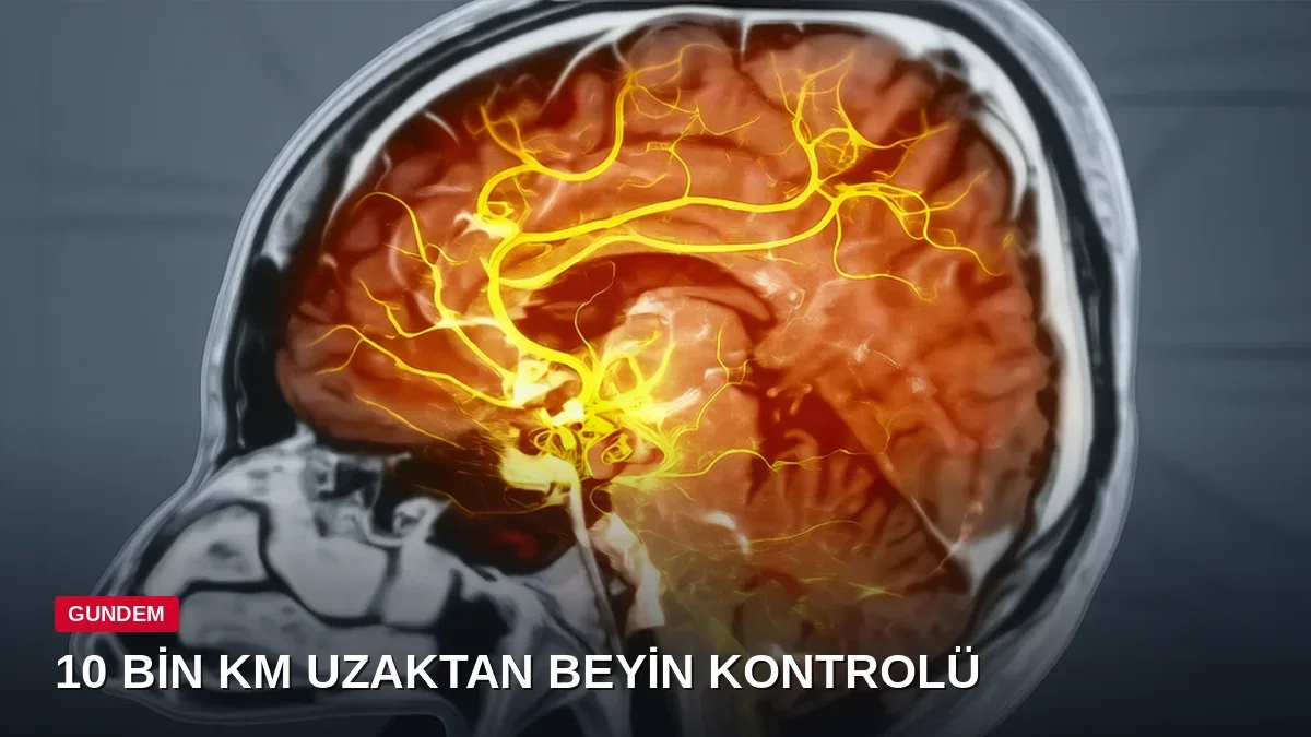 Kıtalar Aşan Beyin Çipi Deneyi Başarıyla Tamamlandı: 10 Bin Kilometreden Uzaktan Kontrol